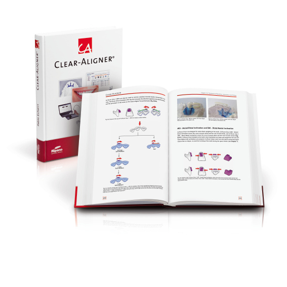 CA® Fachbuch Band 1, CA® CLEAR ALIGNER, Produktbild, Katalog