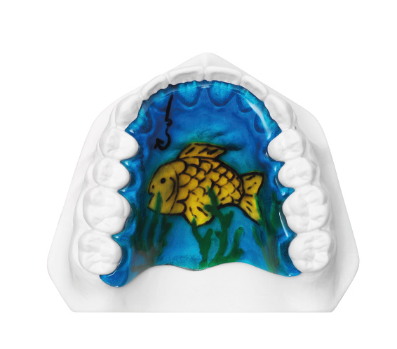 orthodontic plate with fish, application example, online gallery