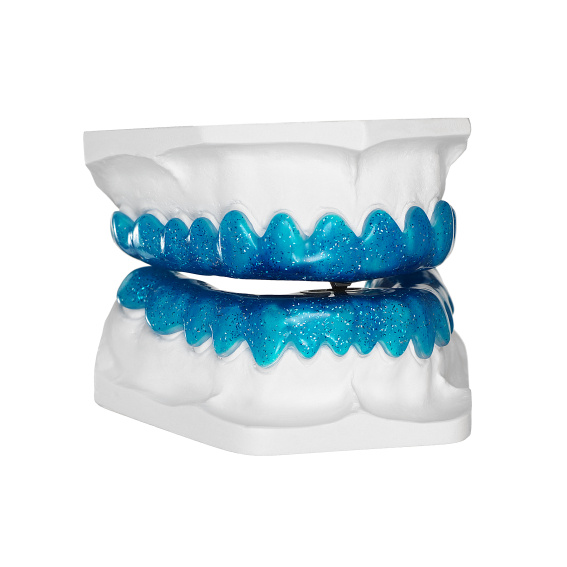 TAP®-T Reverse blau, mit Glimmer silber, Anwendungsbeispiel auf Modell, Galerie (Website)