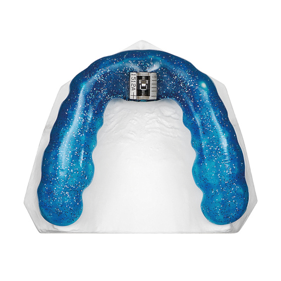 TAP®-T Reverse blue, upper jaw, application example, online gallery