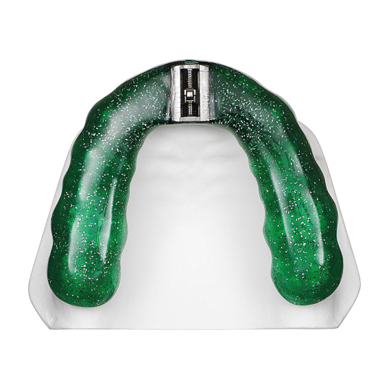 TAP®-T Reverse green, upper jaw, application example, online gallery