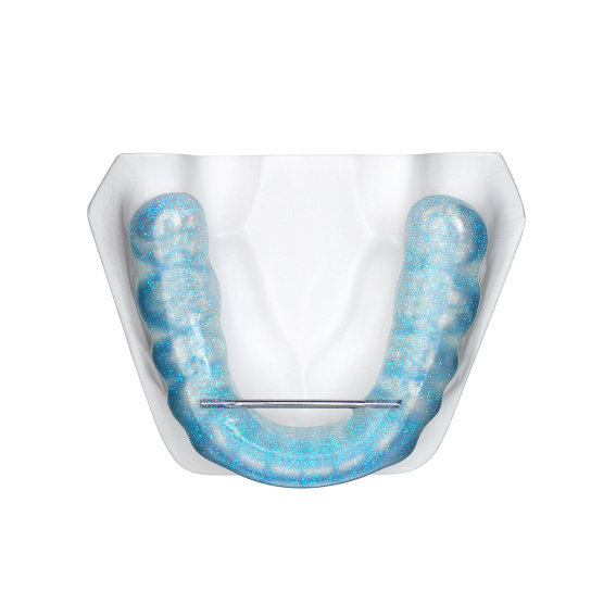 TAP® standard blue, lower jaw, application example, online gallery