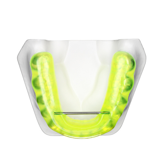 TAP® standard neon yellow, lower jaw, application example, online gallery
