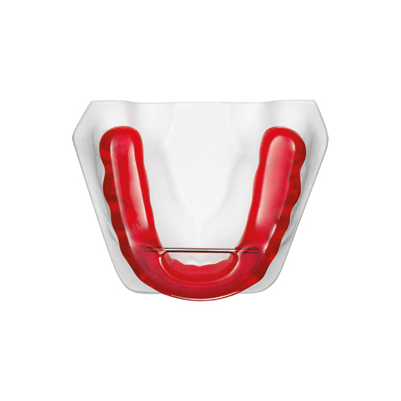 TAP® standard red, lower jaw, application example, online gallery