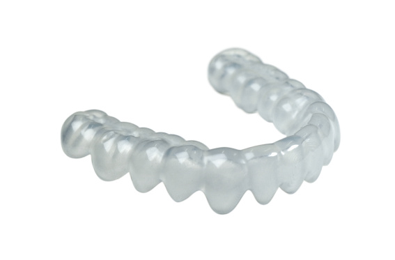 IMPRIMO® LC Splint flex, 3D printing, resin, digital orthodontics, application example, catalogue